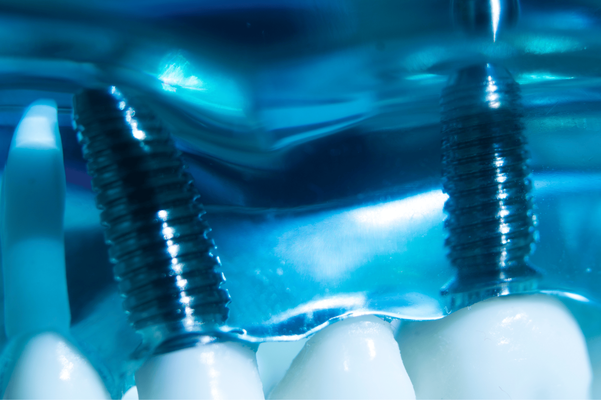 B2B dental tech PR marketing 3