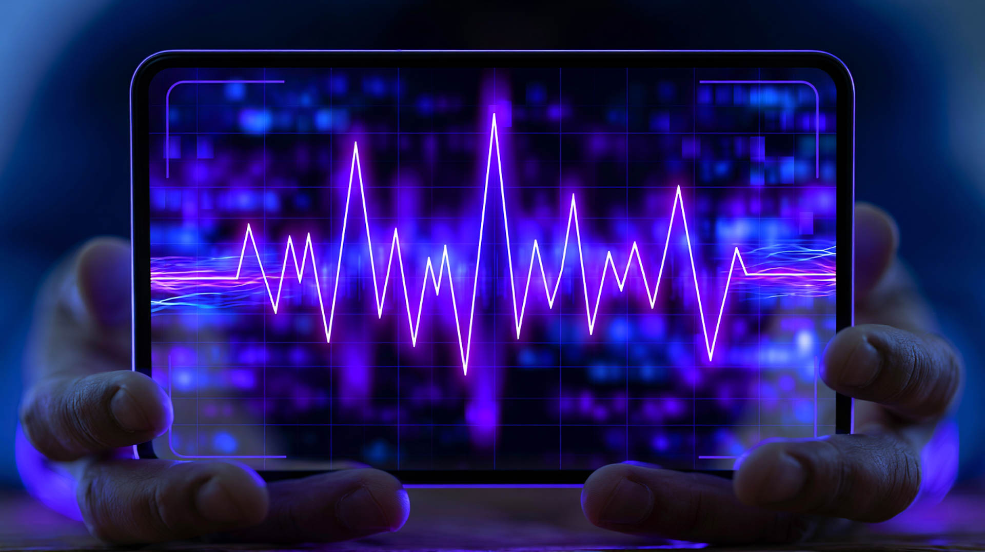 Ecocardiogram